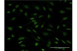 Immunofluorescence of monoclonal antibody to CDC2L6 on HeLa cell.