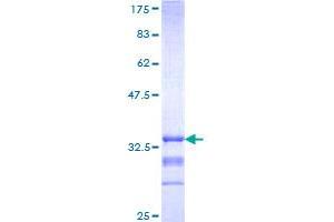 MC3R Protein (AA 1-74) (GST tag)