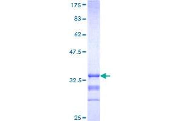 MC3R Protein (AA 1-74) (GST tag)