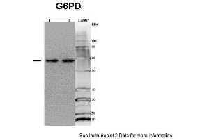 Sample type: 1. (Glucose-6-Phosphate Dehydrogenase antibody  (Middle Region))