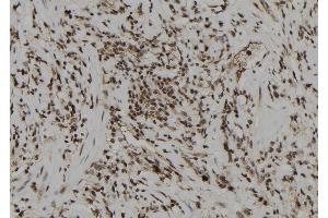 ABIN6274008 at 1/100 staining Human gastric tissue by IHC-P. (DUSP6 antibody  (Internal Region))