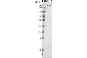 Western Blotting (WB) image for PR Domain Containing 10 (PRDM10) protein (DYKDDDDK Tag) (ABIN2669661)