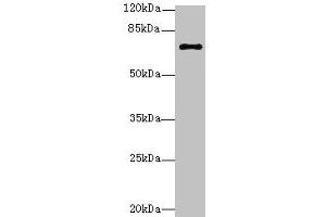 Western blot All lanes: RHOBTB3 antibody at 12 μg/mL + Hela whole cell lysate Secondary Goat polyclonal to rabbit IgG at 1/10000 dilution Predicted band size: 70 kDa Observed band size: 70 kDa (RHOBTB3 antibody  (AA 251-500))