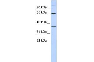 WB Suggested Anti-EPN2 Antibody Titration: 0. (Epsin 2 antibody  (Middle Region))