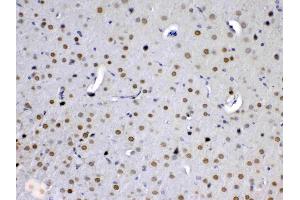 IHC analysis of MED15 using anti-MED15 antibody .