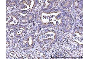 IHC analysis of ATP5F1B using anti-ATP5F1B antibody (ABIN7599866). (Atp5f1b (AA 123-529) antibody)