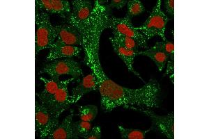 Immunofluorescence Analysis of A549 cells labeling KRT4 with Cytokeratin 4 Mouse Monoclonal Antibody (KRT4/2804)followed by Goat anti-Mouse IgG-CF488 (Green). (KRT4 antibody  (AA 181-292))
