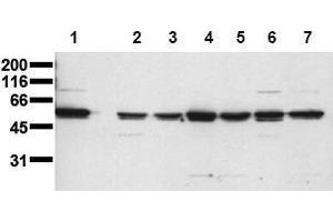 Western Blotting (WB) image for anti-V-Yes-1 Yamaguchi Sarcoma Viral Oncogene Homolog 1 (YES1) (N-Term) antibody (ABIN126915) (YES1 antibody  (N-Term))