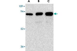 Western blot analysis of (A) 25 ng, (B) 50 ng, and (C) 100 ng of purified recombinant NGFR with NGFR polyclonal antibody  at 1 ug/mL .