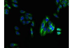 Immunofluorescent analysis of HepG2 cells using ABIN7158748 at dilution of 1:100 and Alexa Fluor 488-congugated AffiniPure Goat Anti-Rabbit IgG(H+L) (LPAR4 antibody  (AA 1-43))