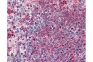 Immunohistochemistry analysis of human spleen tissue stained with TNF receptor 1 pAb at 10 μg/mL. (TNFRSF1A antibody)