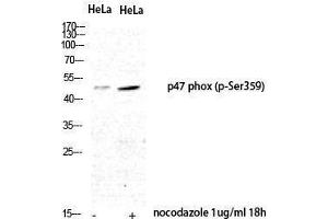 Western Blotting (WB) image for anti-Neutrophil Cytosol Factor 1 (NCF1) (pSer359) antibody (ABIN3182821) (NCF1 antibody  (pSer359))