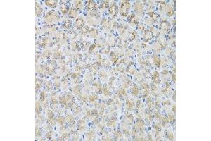 Immunohistochemistry of paraffin-embedded mouse stomach using ARFGAP3 antibody at dilution of 1:100 (x40 lens). (ARFGAP3 antibody)