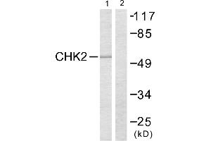 Western blot analysis of extracts from COS7 cells, treated with UV (30mins), using Chk2 (Ab-383) antibody. (CHEK2 antibody)