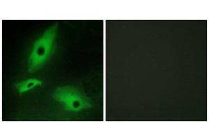 Immunofluorescence (IF) image for anti-Lymphotoxin beta Receptor (TNFR Superfamily, Member 3) (LTBR) (N-Term) antibody (ABIN1849342) (LTBR antibody  (N-Term))