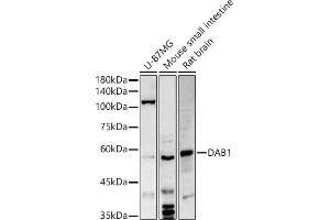 Western blot analysis of extracts of various cell lines, using D antibody (ABIN6130320, ABIN6139385, ABIN6139386 and ABIN6214572) at 1:500 dilution. (DAB1 antibody  (AA 1-185))