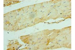 Immunohistochemistry of paraffin-embedded human skeletal muscle tissue using ABIN7175850 at dilution of 1:100 (WISP2 antibody  (AA 1-250))