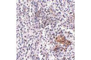 Immunohistochemistry (IHC) image for anti-Leucine-rich repeat protein SHOC-2 (SHOC2) (N-Term) antibody (ABIN1031560) (SHoc2/Sur8 antibody  (N-Term))