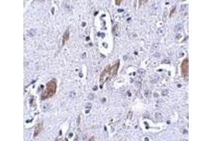 Immunohistochemistry of ATOH8 in mouse brain tissue with this product atOH8 antibody at 5 μg/ml. (ATOH8 antibody  (C-Term))