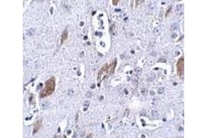 Immunohistochemistry of ATOH8 in mouse brain tissue with this product atOH8 antibody at 5 μg/ml.