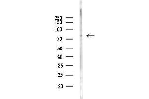 anti-Gastric Inhibitory Polypeptide Receptor (GIPR) (Internal Region) antibody