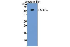 Western Blotting (WB) image for anti-Erythropoietin Receptor (EPOR) (AA 276-496) antibody (ABIN1858733)