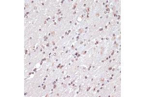 Immunohistochemistry of paraffin-embedded rat brain using c-Jun antibody (ABIN6131074, ABIN6142670, ABIN6142671 and ABIN6215187) at dilution of 1:100 (40x lens). (C-JUN antibody  (AA 1-70))