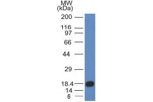 Image no. 1 for anti-Mast/stem Cell Growth Factor Receptor (KIT) (AA 100-300) antibody (ABIN6190789) (KIT antibody  (AA 100-300))