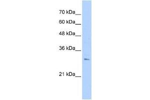 RHBDL2 antibody used at 1 ug/ml to detect target protein. (RHBDL2 antibody)