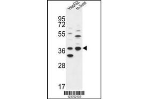 Western blot analysis in HepG2 cell line and mouse liver tissue lysates (35ug/lane). (DHRS3 antibody  (AA 85-113))