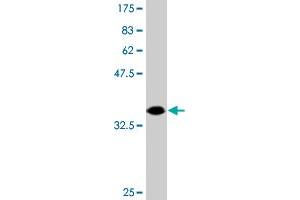 Western Blot detection against Immunogen (47. (DIP2A antibody  (AA 107-301))