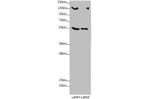 Western blot All lanes: CSPP1 antibody at 1. (CSPP1 antibody  (AA 997-1256))