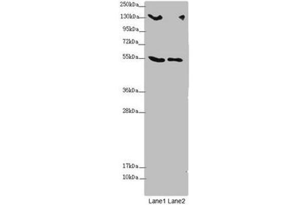 CSPP1 Antikörper  (AA 997-1256)