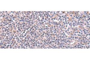 Immunohistochemistry of paraffin-embedded Human tonsil tissue using GMDS Polyclonal Antibody at dilution of 1:70(x200) (GMDS antibody)