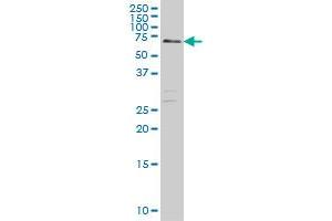 CARF monoclonal antibody (M03), clone 1E10 Western Blot analysis of CARF expression in Hela S3 NE . (CDKN2AIP antibody  (AA 1-579))