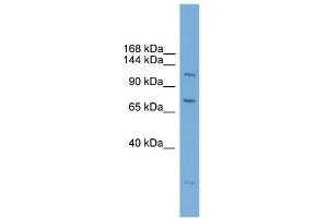 WB Suggested Anti-PAntibody Titration:  0. (PARP10 antibody  (N-Term))