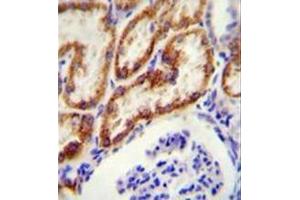Immunohistochemistry analysis in formalin fixed and paraffin embedded human kidney tissue reacted with Glycine amidinotransferase antibody (N-term) followed by peroxidase conjugation of the secondary antibody and DAB staining. (GATM antibody  (N-Term))