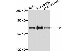 Western blot analysis of extracts of various cell lines, using LRIG1 antibody. (Lrig1 antibody)