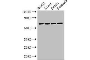 Western Blot Positive WB detected in: HepG2 whole cell lysate, Rat liver tissue, Rat brain tissue, Rat stomach tissue All lanes: RCBTB2 antibody at 3.