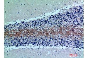 Immunohistochemistry (IHC) analysis of paraffin-embedded Human Brain, antibody was diluted at 1:200. (C7 antibody)