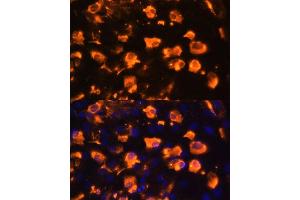 Immunofluorescence analysis of C6 cells using J antibody (ABIN7268035) at dilution of 1:100. (JAG2 antibody  (AA 24-200))