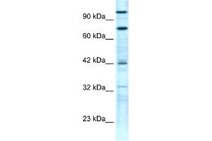 WB Suggested Anti-ZNF23 Antibody Titration:  0.