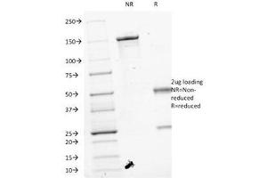 SDS-PAGE Analysis of Purified, BSA-Free VEGF Antibody (clone VEGF/1063).