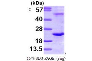 SDS-PAGE (SDS) image for TATA-Binding Protein-Associated Phosphoprotein (DR1) (AA 1-176) protein (His tag) (ABIN667179)