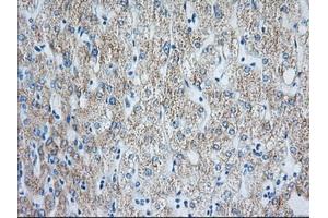 Immunohistochemical staining of paraffin-embedded Human liver tissue using anti-HIBCH mouse monoclonal antibody.