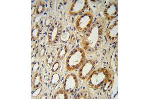 CYP27B1 Antibody (C-term) B immunohistochemistry analysis in formalin fixed and paraffin embedded human kidney tissue followed by peroxidase conjugation of the secondary antibody and DAB staining. (CYP27B1 antibody  (C-Term))