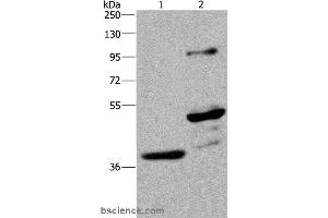 Western blot analysis of Human fetal brain and mouse brain tissue, using GAS7 Polyclonal Antibody at dilution of 1:625 (GAS7 antibody)