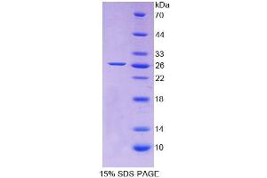 SDS-PAGE analysis of Rat Apolipoprotein A5 Protein. (APOA5 Protein)