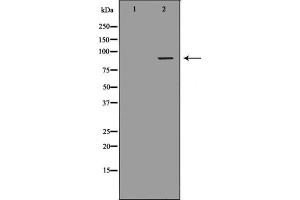 Western blot analysis of extracts from Jurkat cells, using DVL2 antibody. (DVL2 antibody  (C-Term))