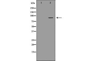 Western blot analysis of extracts from Jurkat cells, using DVL2 antibody.